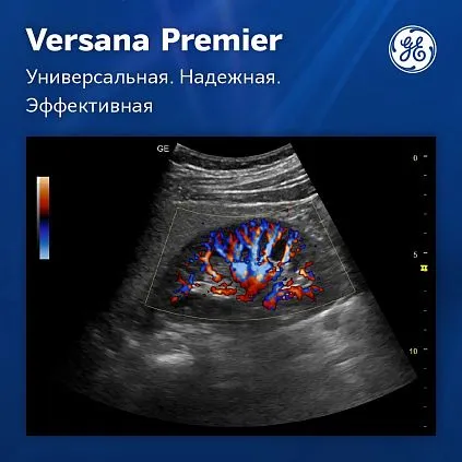 Клинические изображения Ультразвуковая система GE Versana Premier Platinum